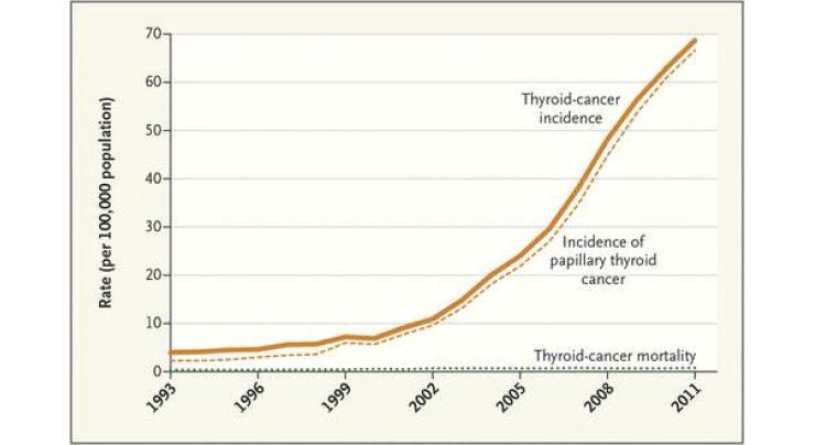 Thyroid cancer 'epidemic' down to overdiagnosis: study