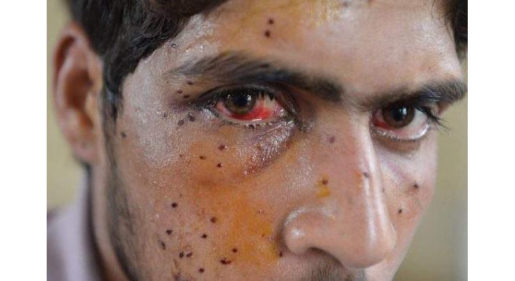 APHC expresses shock over more pellet consignments to IOK 