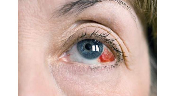 Eye diseases increasing: Professor Dr. Mirani 