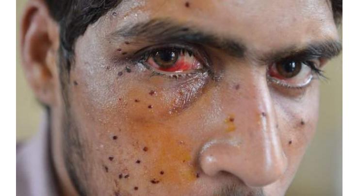 India's crackdown in Kashmir: is this the world's first mass 