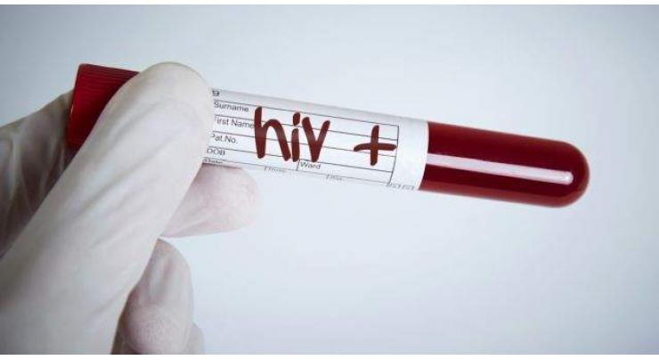 Half of HIV positive patients belong to age group of less then 25- 