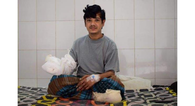 Bangladesh 'Tree Man' sees hope after 16 surgeries 