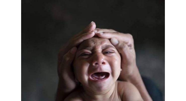 Children with 'normal' heads may have Zika brain damage: study 