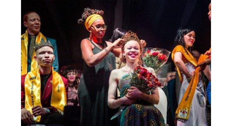 Zimbabwe holds Miss Albinism beauty pageant to fight stigma
