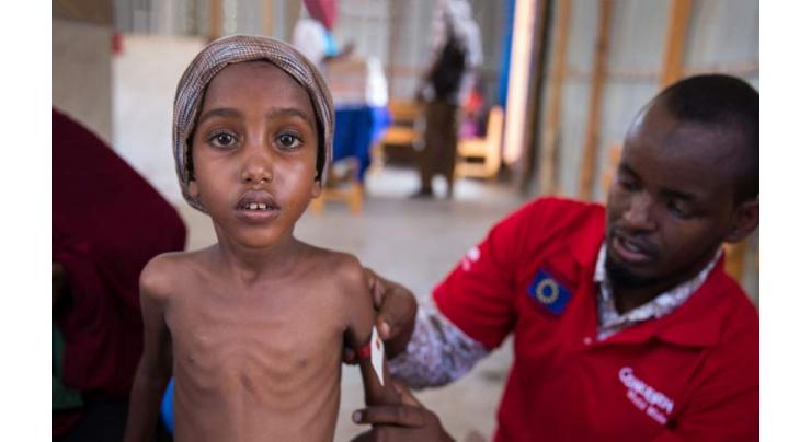   Every 9th Person Faced Undernourishment Worldwide in 2017 - UN Report