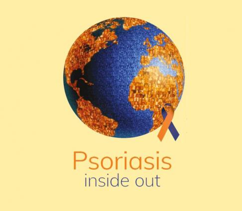 World Psoriasis Day Being Observed Today Urdupoint - 