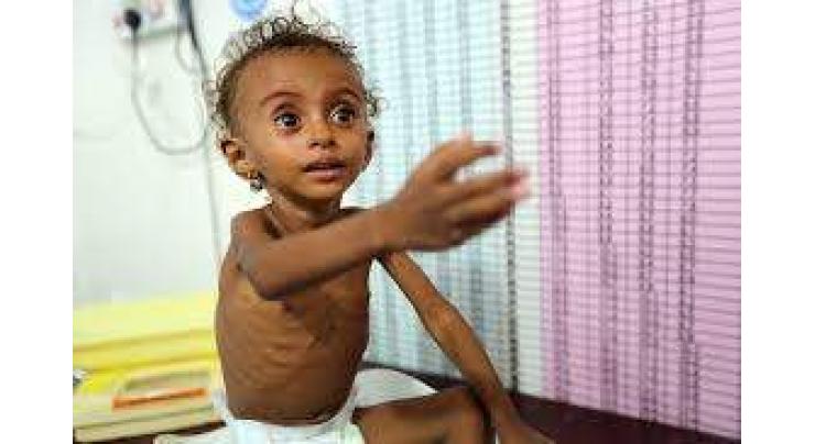 Yemen's war must end to deal with starvation, UN food aid chief says
