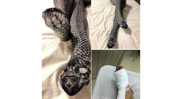 Woman wears ‘Snake looking’ stockings; husband beats her mistaking it for two real snakes