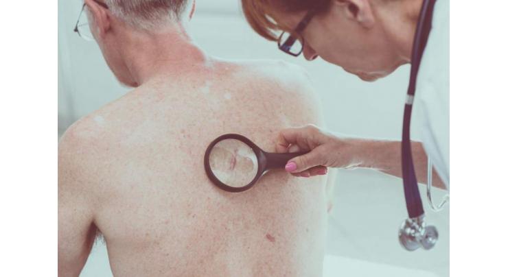 Laser probe detects deadly melanoma in seconds