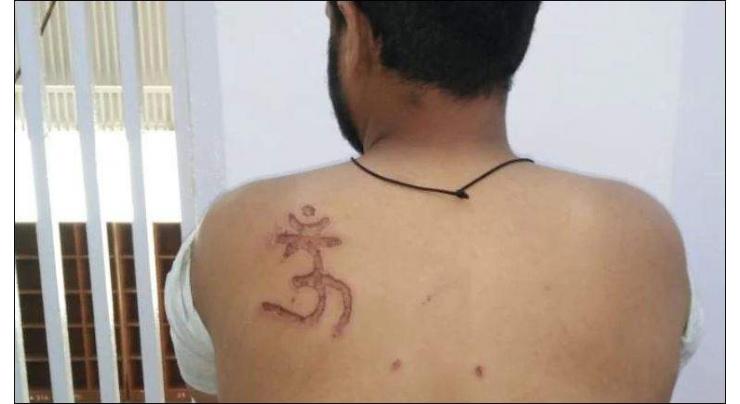 Muslim man tortured, branded with ‘Om’ symbol in Indian jail