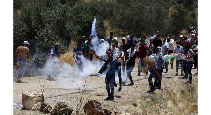 Palestinian child shot in head during West Bank clashes: Ministry
