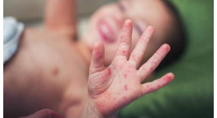 Measles death toll in Samoa rises to 15: UNICEF

