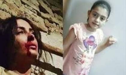 مشھد مسلسل ” خاتون “ یسبب انتحار طفلة سوریة