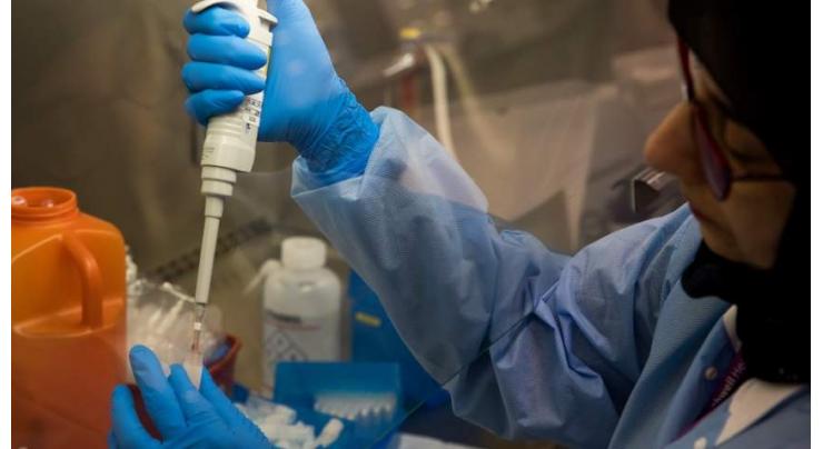 Germany says widespread testing keeping virus deaths low
