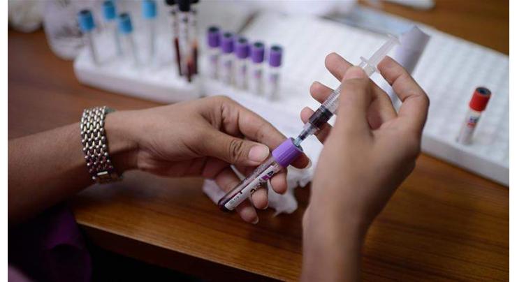 Punjab Healthcare Commission to seizure laboratories conducting rapid test for COVID-19

