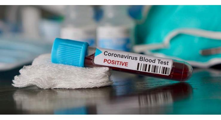 22 more tested positive for coronavirus in Hyderabad

