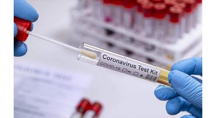 Researchers develop cheaper, faster, accurate Covid-19 test
