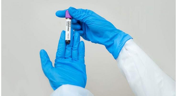 Japan to start new round of coronavirus antibody tests on 15,000 people
