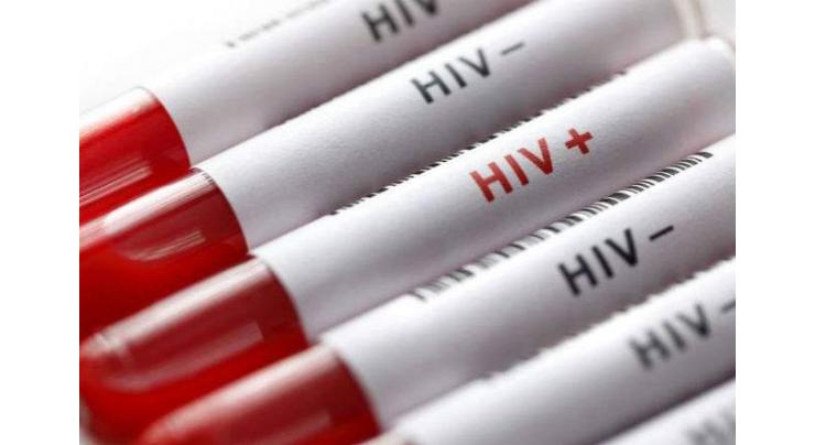 24,290 out of 0.19 million HIV carries in Pakistan receiving treatment
