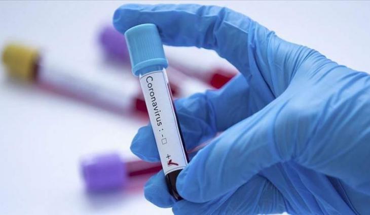 67 more Covid-19 cases reported in district