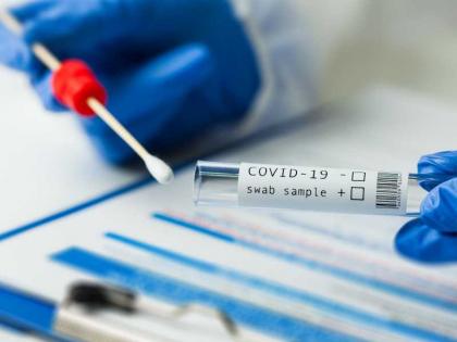 دراسة تأثير المسح الشامل لكوفيد-19 في الإمارات تؤكد فاعلية برنامج الفحوصات لاحتواء انتشار المرض