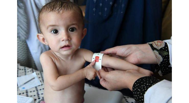 Half of Afghan Children Under 5 to Suffer From Acute Malnutrition By 2022 - UNICEF