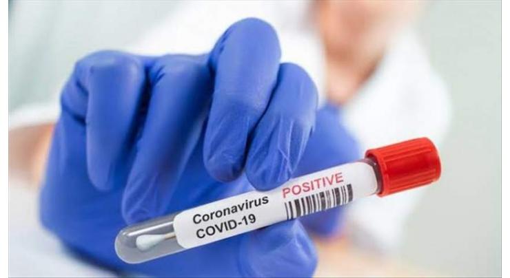 7 die, 146 test positive for coronavirus
