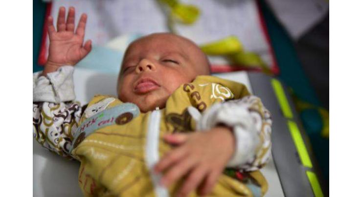 UNICEF supporting Pakistan to expand Kangaroo Mother Care facilities
