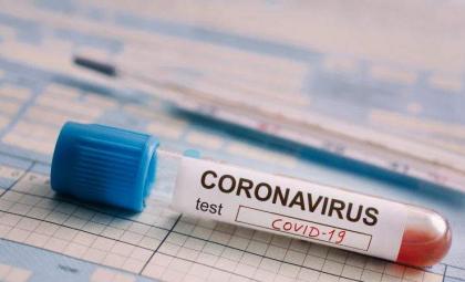 Seven more diagnosed with deadly coronavirus in RWP
