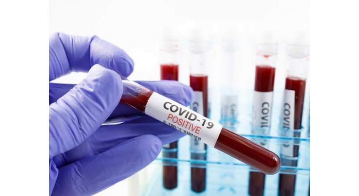 101 more tested positive for Covid-19 in Hyderabad
