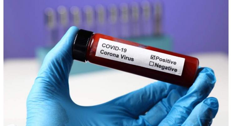 856 fresh Covid-19 cases reported in capital
