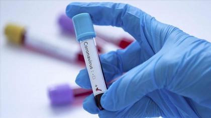 15 more tested positive for coronavirus in Balochistan
