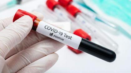 39 more test positive for COVID-19 in Faisalabad
