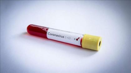 1446 new coronavirus cases confirmed in KP
