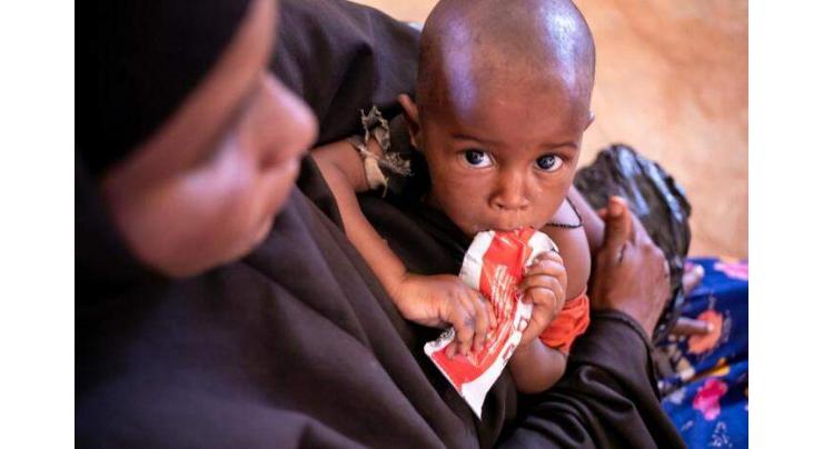 Price hike may cause malnutrition in children, lactating mothers
