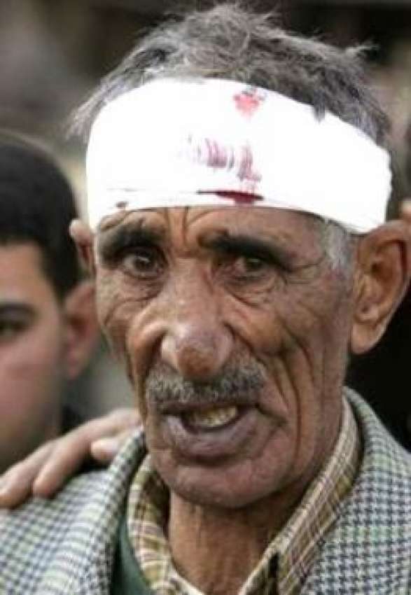 بغداد، خود کش حملوں میں‌ شدید زخمی ہونے والا ایک بزرگ شہری ..