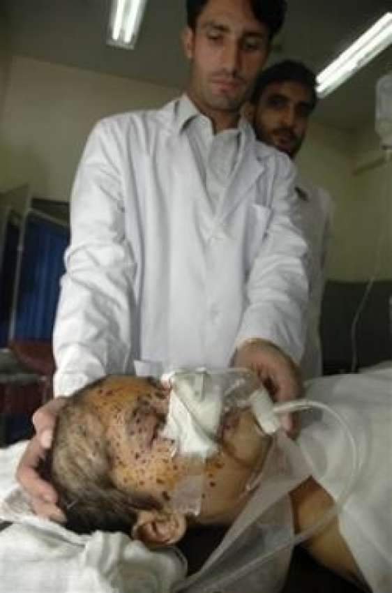 پشاور،مقامی ہسپتال میں ڈاکٹر  پاک فوج اور  مبینہ شرپسندوں‌کے ..