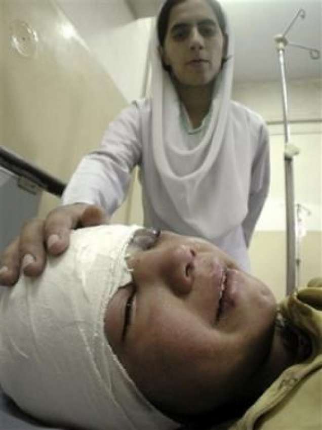 پشاور،ایک نرس ہسپتال میں پاک فضائیہ کی بمباری سے زخمی ہونیوالے ..