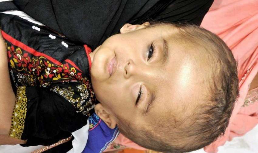 کراچی: عجیب و غریب بیماری میں مبتلا حیدر آباد کی رہائشی بچی ..