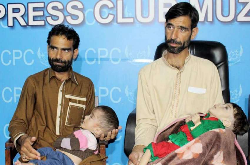 مظفر آباد: زندگی اور موت کی کشمکش میں مبتلا دو سالہ بریرا ..