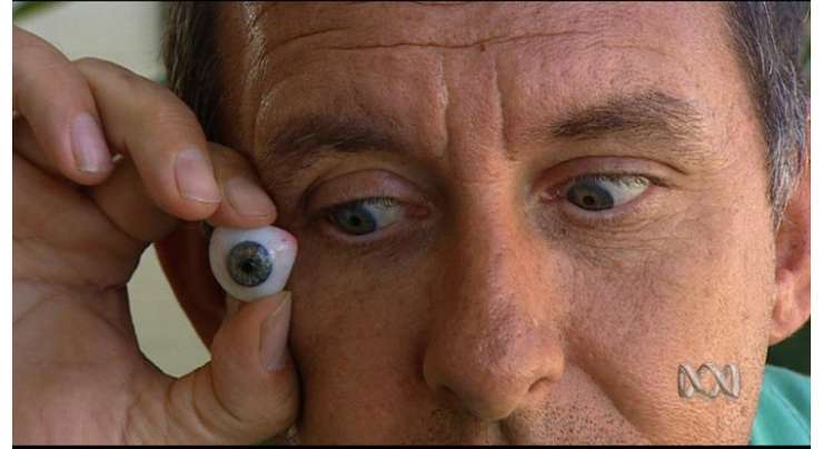 آسٹریلوی سائنس دانوں نے مصنوعی آنکھ متعارف کرا دی