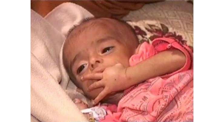 لاہور میں سرکاری ڈاکٹروں کی جانب سے مردہ قرار دی گئی بچی زندہ ہوگئی