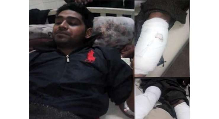 لاہور :وڈیرے کا حجام پر بیہمانہ تشدد ، ٹانگوں میں گولیاں مار دیں