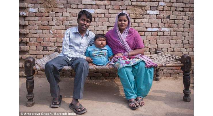 دس ماہ کی بچی کا وزن اس کی زندگی کے لیے خطرہ بن گیا