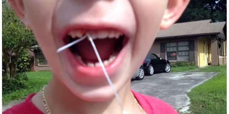 دانت نکالنے کا یہ طریقہ ڈینٹسٹ بالکل نہ دیکھیں
