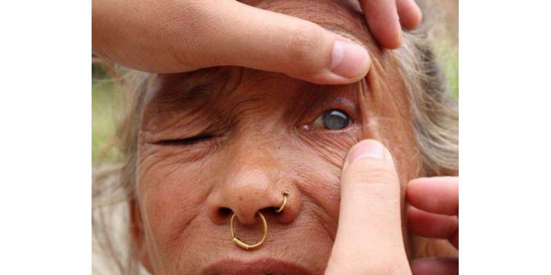 نیپال: پانچ منٹ میں بینائی واپس لانے والا انوکھا ڈاکٹر