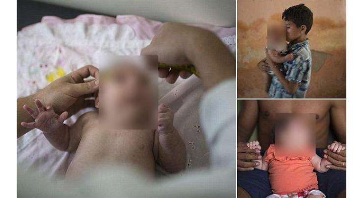 لاطینی امریکہ: زِکا وائرس سے متاثرہ ماوٴں کے ہاں غیر معمولی چھوٹے سروں والے بچوں کی پیدائش میں مزید اضافہ