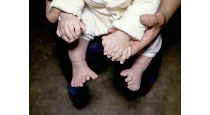 چین میں 31 انگلیوں والے بچے کی پیدائش