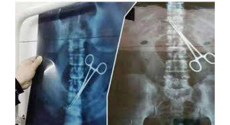 حائل میں مصری ڈاکٹر مریض کے پیٹ میں قینچی بھول گیا