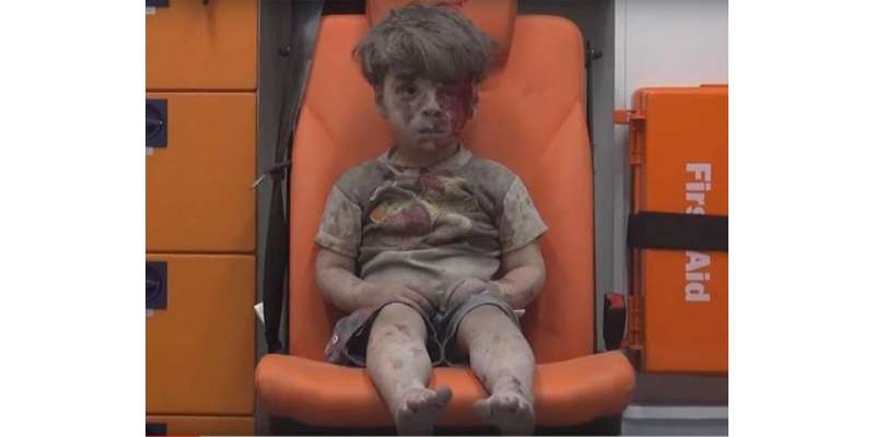 شامی شہر حلب میں بمباری سے 5 سال کے بچے اومران کے زخمی ہونے کا واقعہ، ..